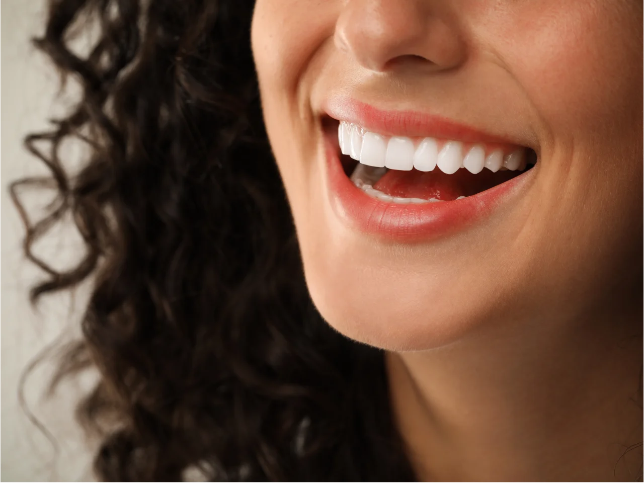 Close-up of woman's bright white smile showing beautiful cosmetic dental results