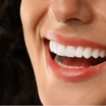 Close-up of woman with curly hair showing bright white smile