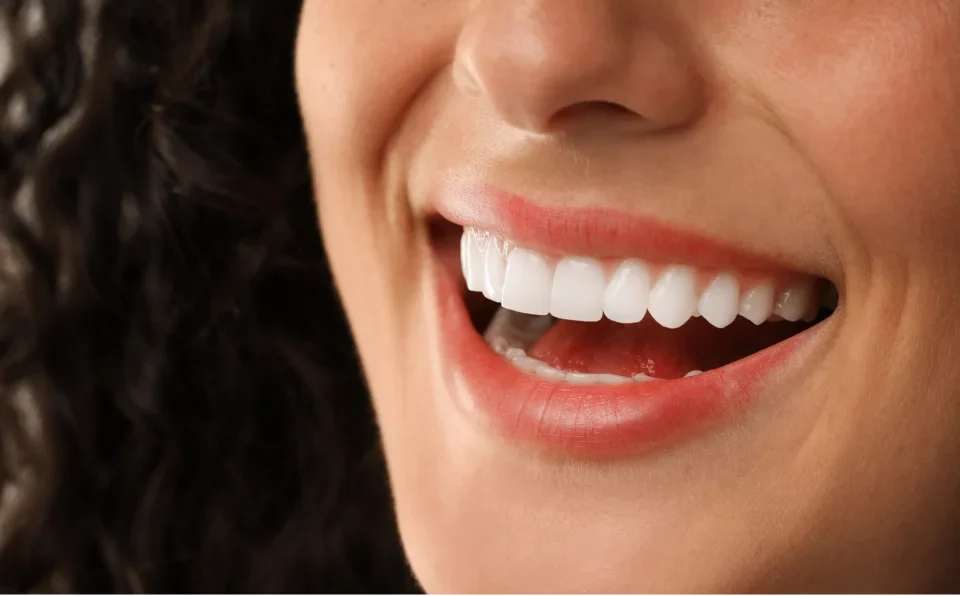 Close-up of woman with curly hair showing bright white smile