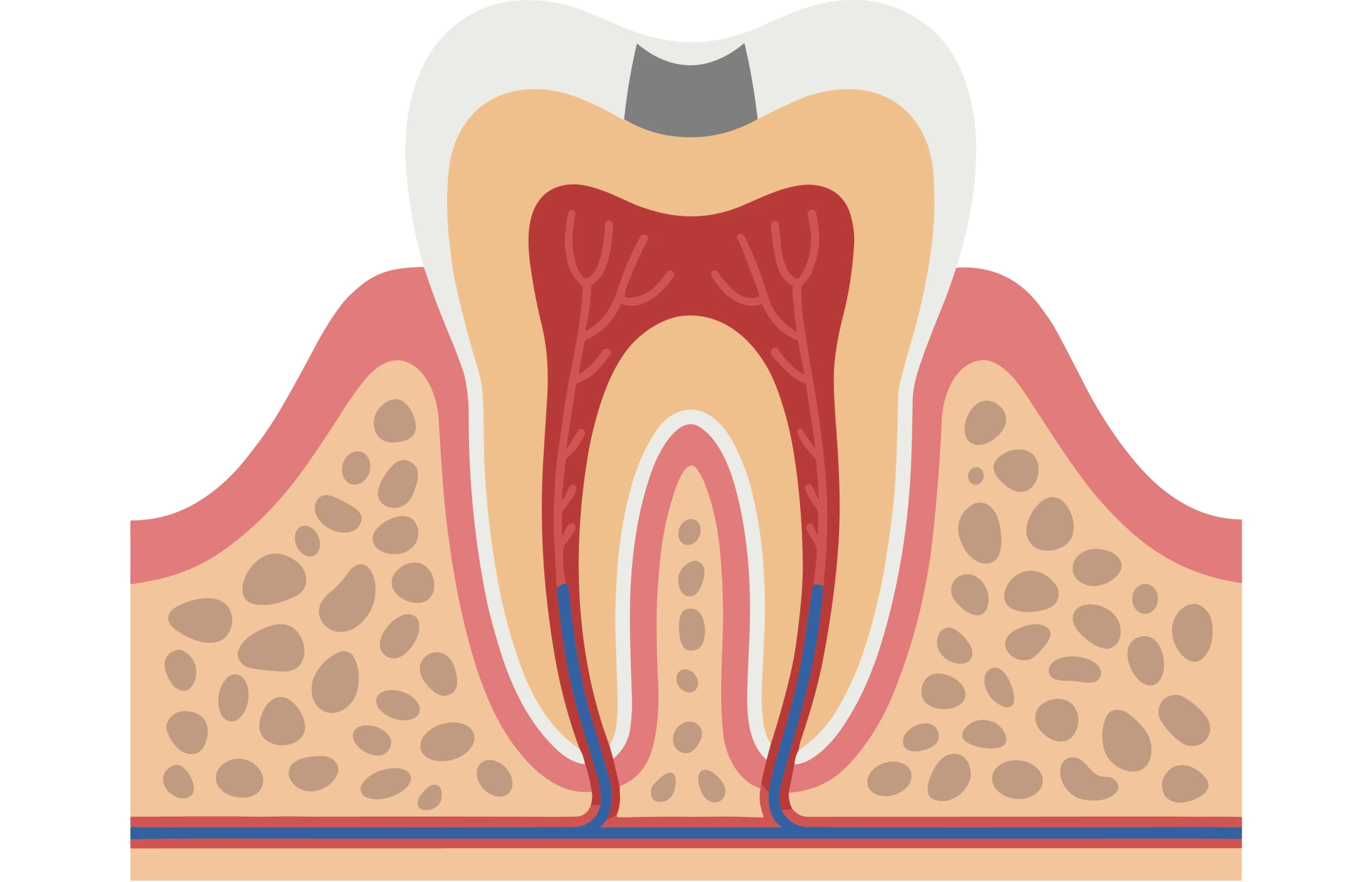 Cross-section illustration of tooth showing dental filling inside tooth structure with roots and surrounding bone