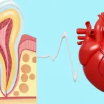 Diagram of the oral-systemic link showing how oral care and gum health affect the heart, provided by Davis Dental Group family dental clinic in Tacoma WA.