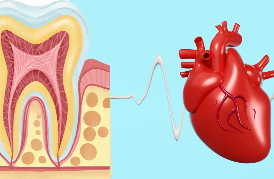 Diagram of the oral-systemic link showing how oral care and gum health affect the heart, provided by Davis Dental Group family dental clinic in Tacoma WA.