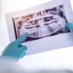Dentist holding panoramic dental X-ray image