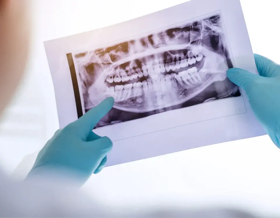 Dentist holding panoramic dental X-ray image