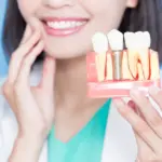 Woman holding dental implant tooth model