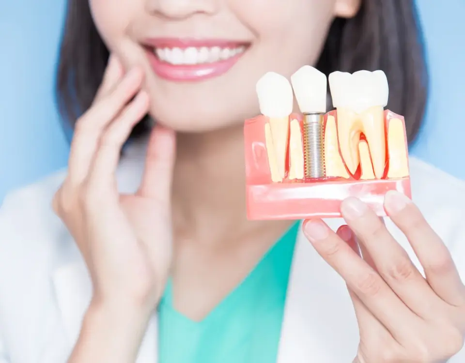 Woman holding dental implant tooth model