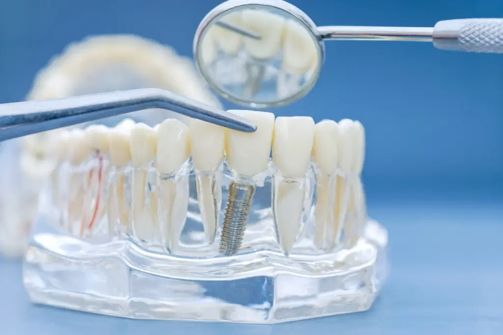 Dental implant model with tools and mirror