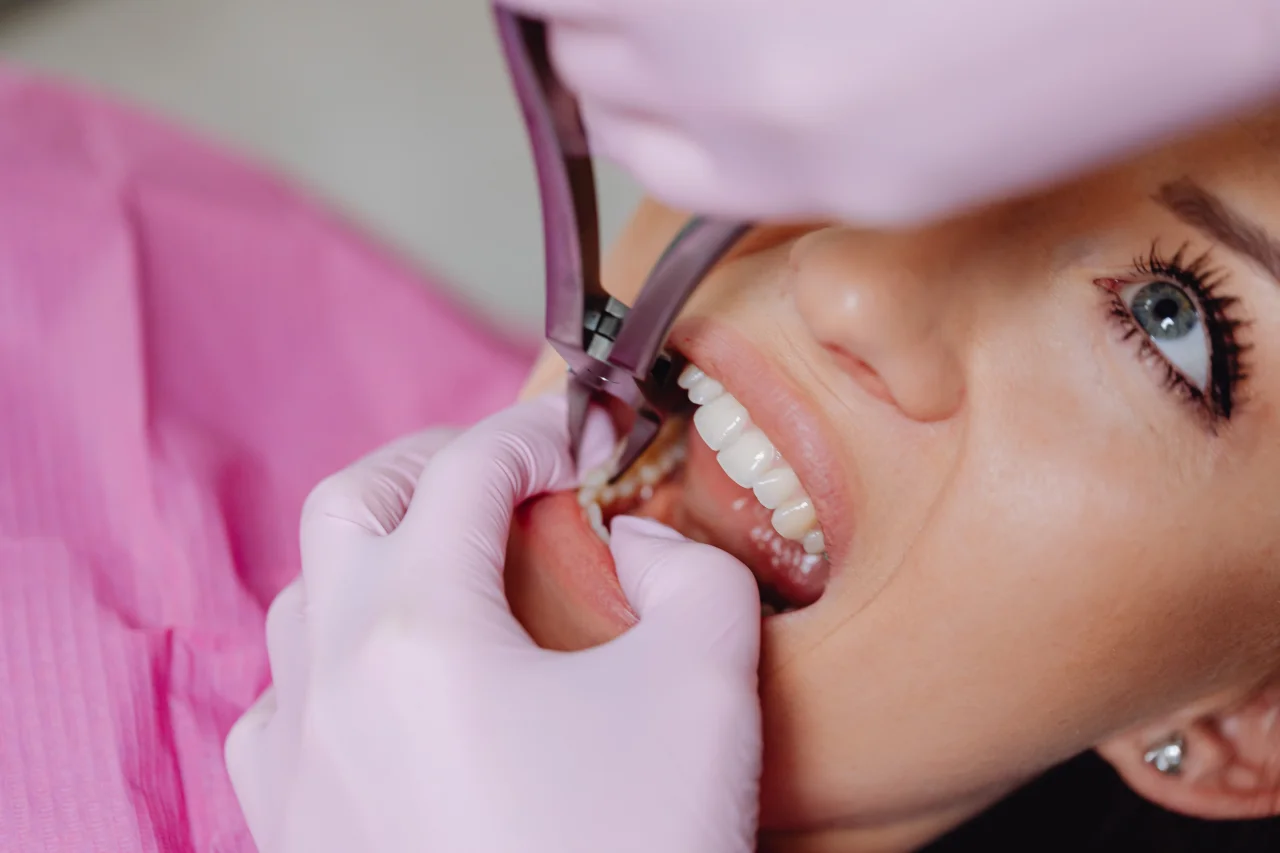 Dentist examining a patient's teeth during a wisdom teeth removal consultation in Tacoma, WA