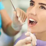 Patient receiving deep cleaning treatment at Davis Dental Group in Tacoma WA